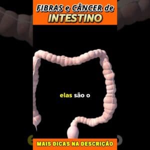 Fibras e Câncer de Intestino