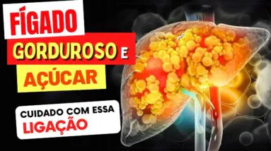 FÍGADO GORDUROSO e AÇÚCAR: A Relação que Pode Arruinar sua Saúde!