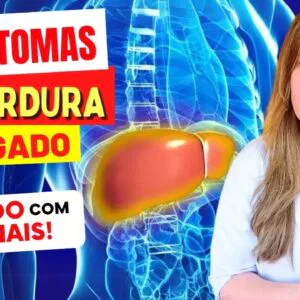 10 SINAIS DE ALERTA para GORDURA NO FÍGADO - Cuidado com estes SINTOMAS!
