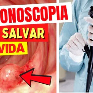 Exame que PREVINE DOENÇAS GRAVES Antes dos Sintomas e Salva Vidas! A Importante COLONOSCOPIA