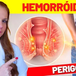 Dor, Coceira Anal ou Sangramento? Sinais de ALERTA de HEMORRÓIDAS
