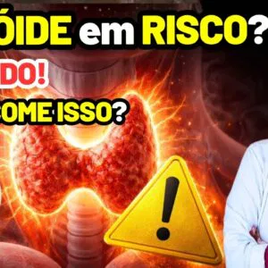 5 Alimentos que podem PREJUDICAR SUA TEREOIDE - Cuidados Importantes