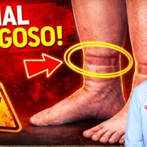 Marca da MEIA na PERNA? NÃO IGNORE! Seu CORAÇÃO pode estar em RISCO