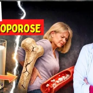 LEITE e OSTEOPOROSE - A VERDADE que NÃO TE CONTAM!